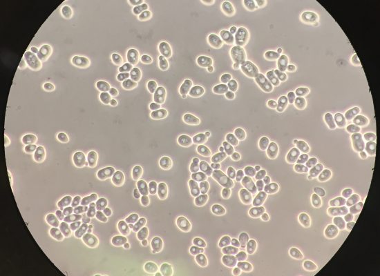 Levaduras de Saccharomyces cerevisiae vistas al microscopio